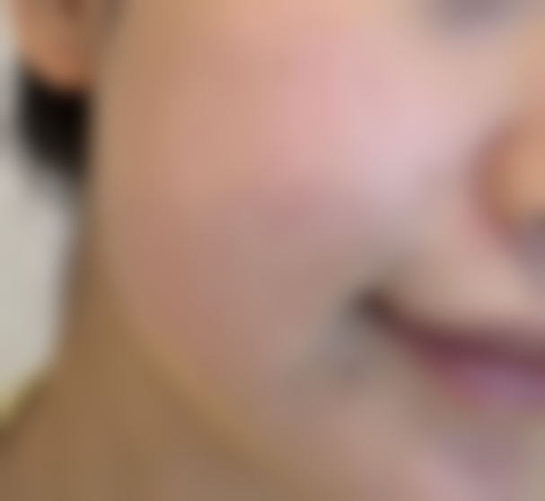 南京嘉怡美水光补水成效惊艳体验