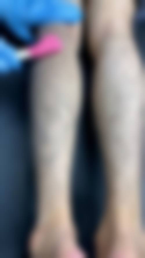 新乡安瑞吉拉医疗美容门诊部收费价格表/收费标准