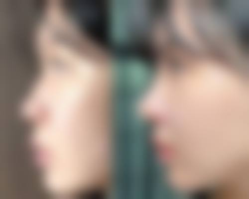 广州华美医疗美容整形医院口碑评价