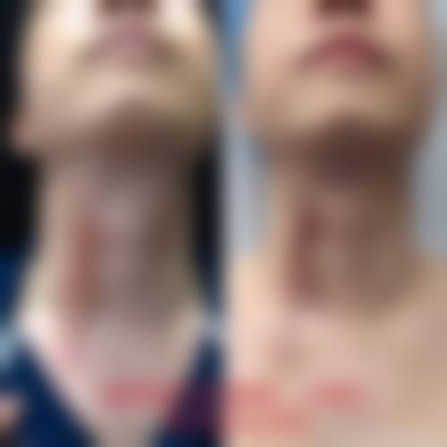 王玉虎医生预约挂号指南