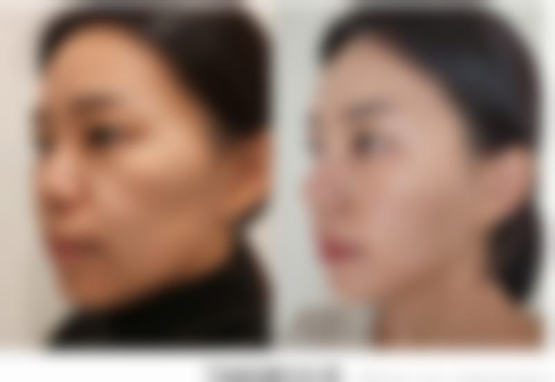 王玉虎医生擅长项目