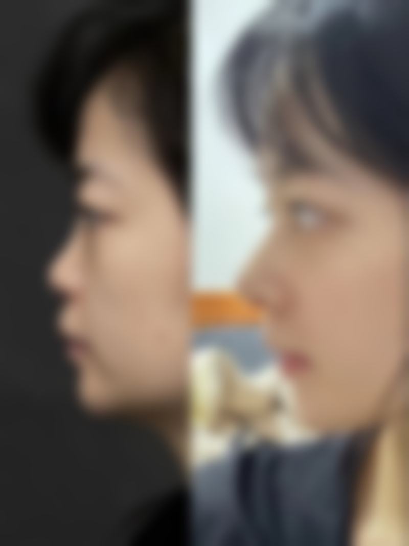 舟山艺涵港东医疗美容诊所收费价格参考