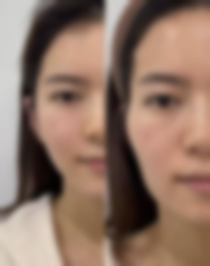 王玉虎医生技术水平分析