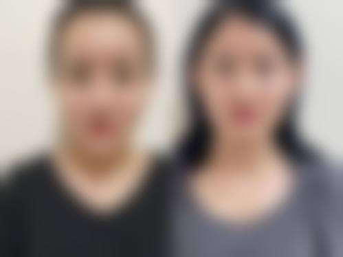 宣城华艺医学整形美容门诊部真人口碑评价怎么样?