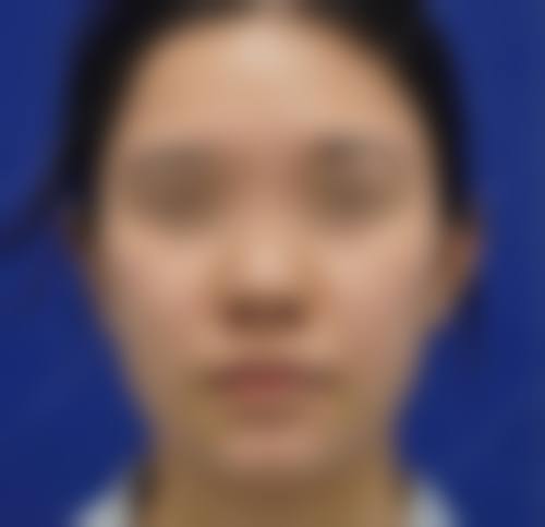 南昌艾莱芙美容医院用户口碑