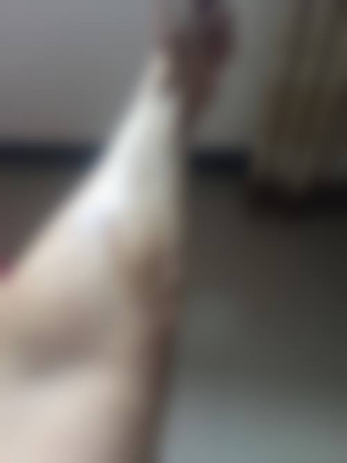 南京瑞鑫烧伤医院口碑评价怎么样？