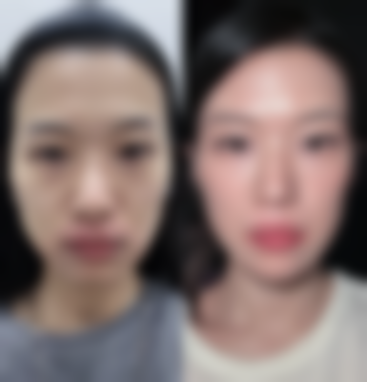 太原璞奢思木整形医院收费贵吗？