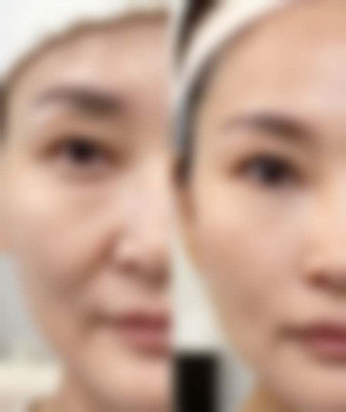 南京瑞鑫烧伤医院特色项目及技术优势