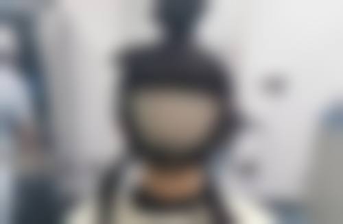 剃头对植发成效的影响