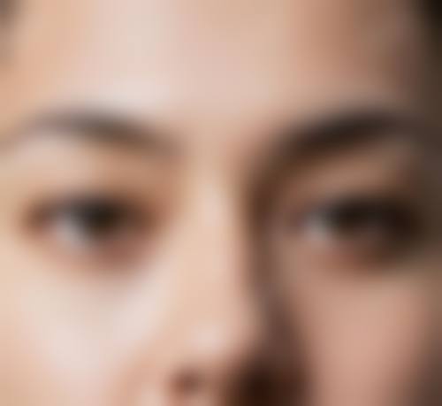 {全切双眼皮好不好修复？修复时机、复杂程度及效果评估全解析