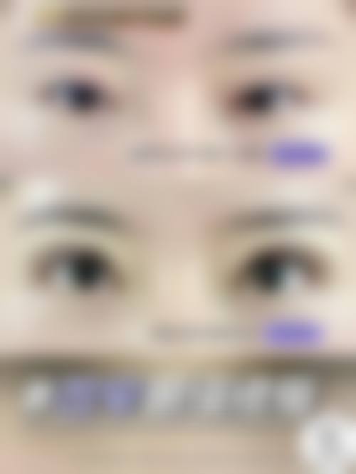 影响热敷时间的因素