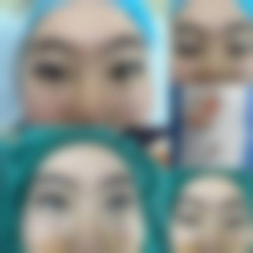 深圳非凡医疗美容医院怎么样？25年品牌沉淀，切开双眼皮1800元起，闭眼冲！ 