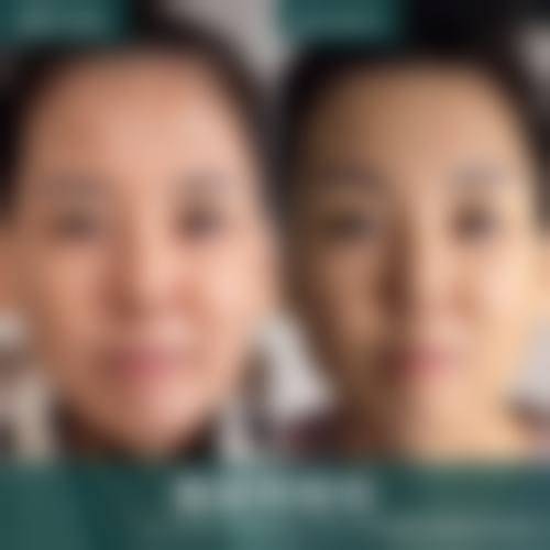 彭州市人民医院美容科特色项目列表