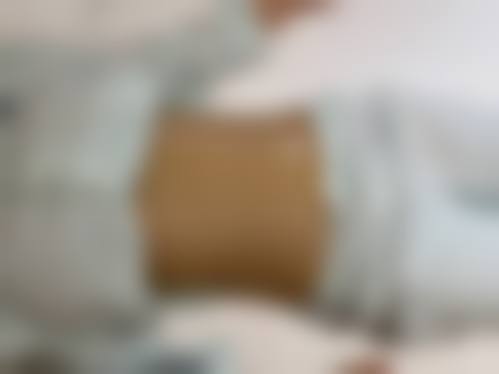 促进胳膊抽脂后消肿的方法