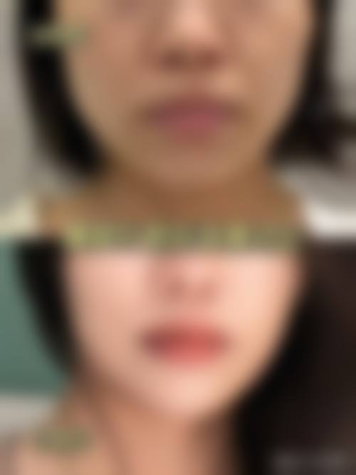 彭州市人民医院美容科用户评价