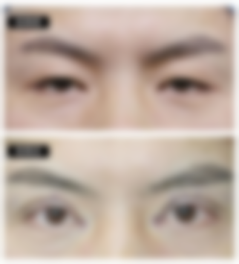 每次热敷的时长