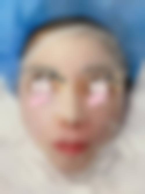 南宁华美整形美容医院2026新版价格表及医生名单揭秘，光子嫩肤1160元起！ 