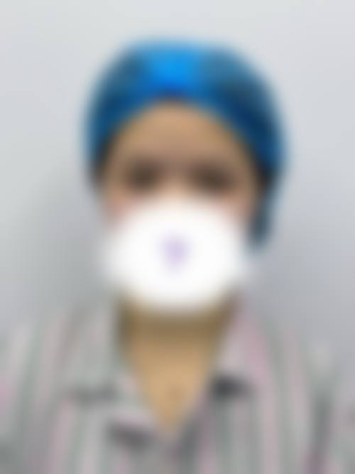 眼部整形：专精医生打造灵动双眸