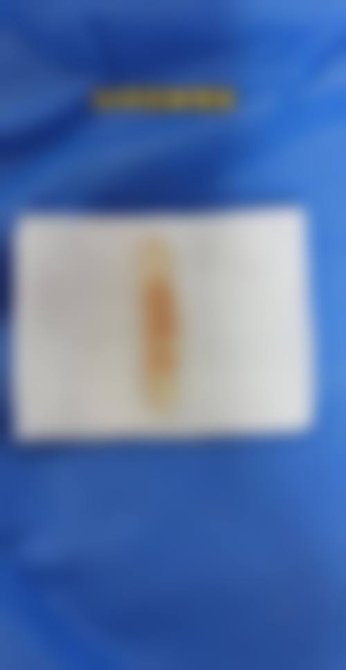 银川市兴庆区慧顶医学美容诊所特色项目列表