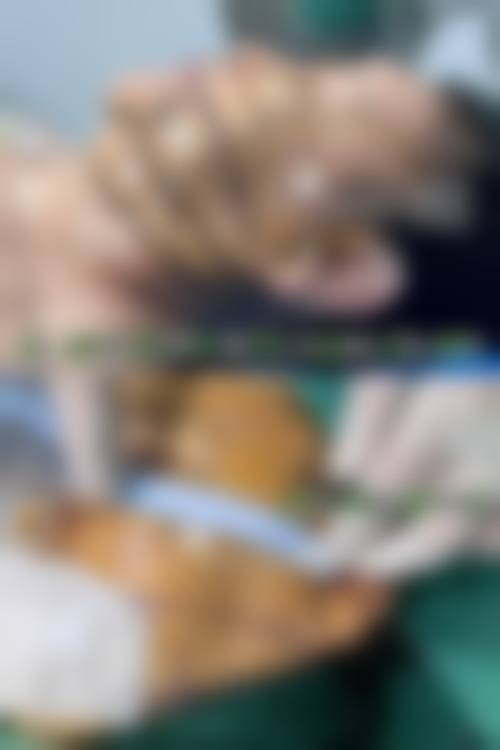 南京曼陀罗整形医院重点项目解析