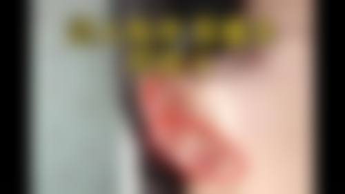 热门整形：多样项目价格大公开