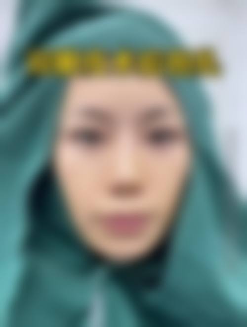 二、广州武警医院整形美容科眼部整形价格详情