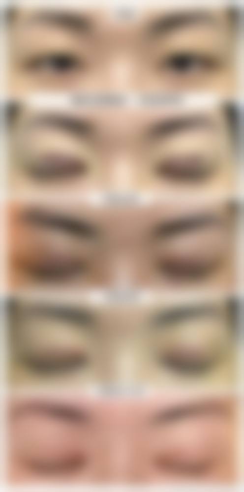 四、广州武警医院整形美容科皮肤美容项目价格解读