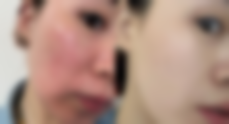 盖雪医生收费贵吗？