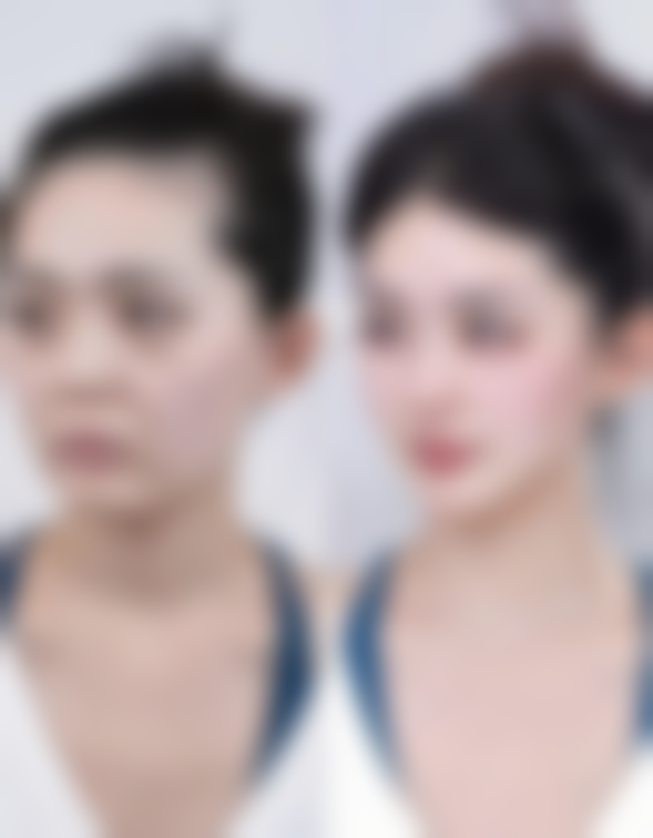 五、广州武警医院整形美容科其他项目价格情况