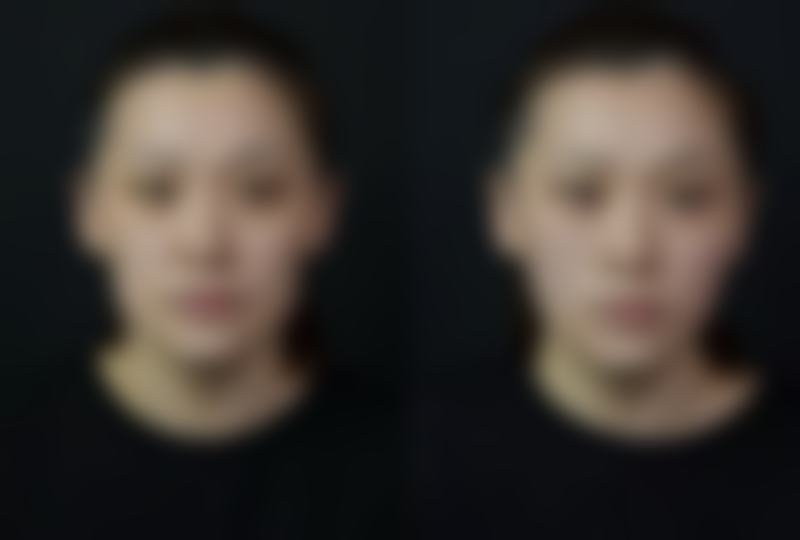 南方医院：华南精尖的颌面与眼鼻具有影响力