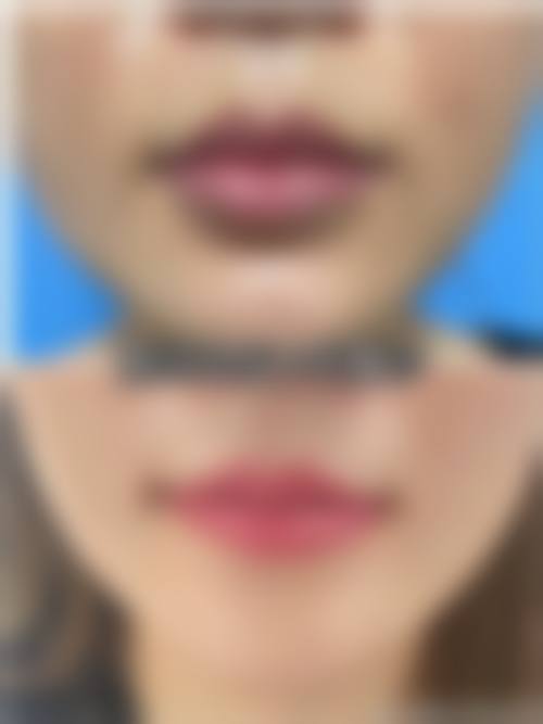 四、卢九宁的预约方式