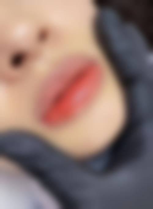 卢九宁在哪家医院？上海丽质，擅人中缩短、直腿术，口碑超棒！ 