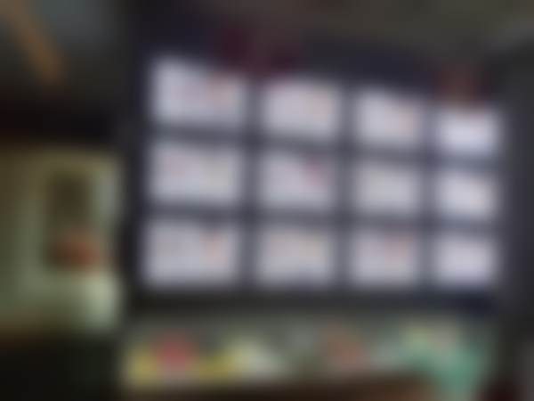 内轮廓T区高光重塑韧带复位提升术的特点