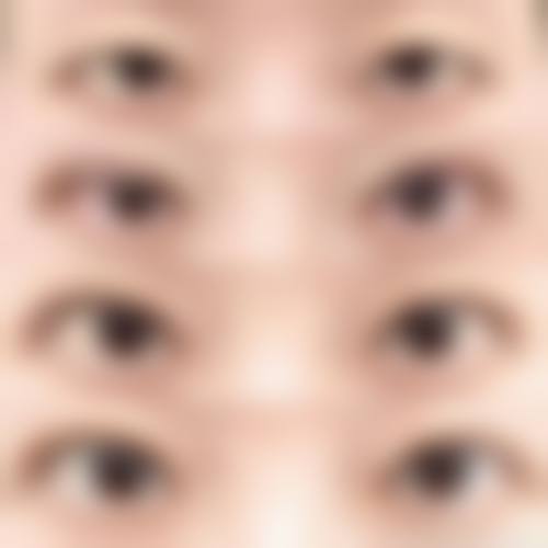 五、术后护理与疤痕愈合瘙痒