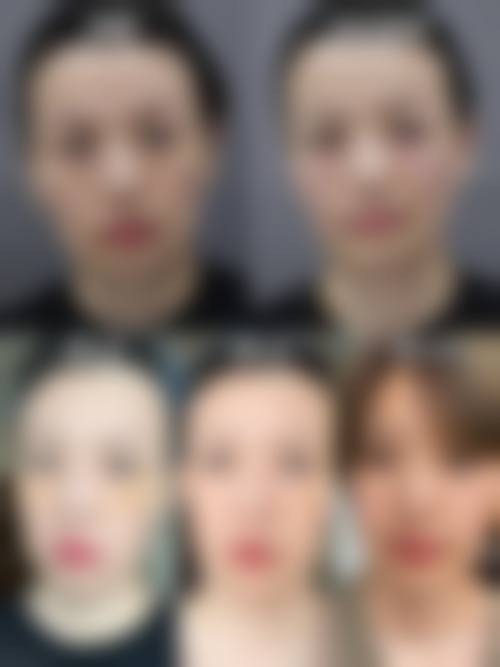 {黑眼圈还有眼袋是什么导致？原来是遗传、睡眠不足、皮肤老化等因素在作祟