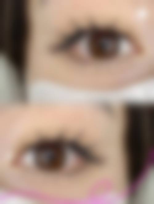 北京怡瑞医疗美容医院重点项目解析