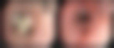 总结：放心选择靠谱医院