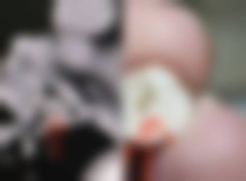 某医疗美容：3D内窥镜微创快速修复