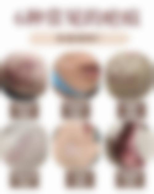 {为什么疤痕愈合后会痒？可能是因为个人属于疤痕体质，伤口愈合后局部就会变红、发痒