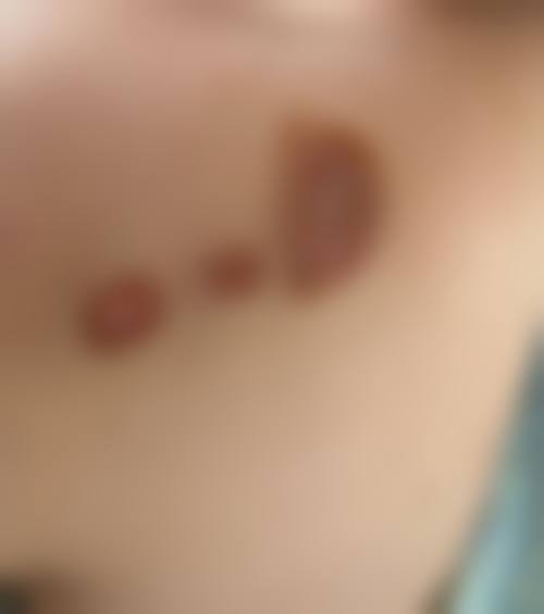 请你补充“烟台治疗瘢痕疙瘩医院排行榜null，null”中“null，null”的具体内容，以便我生成符合要求的标题。