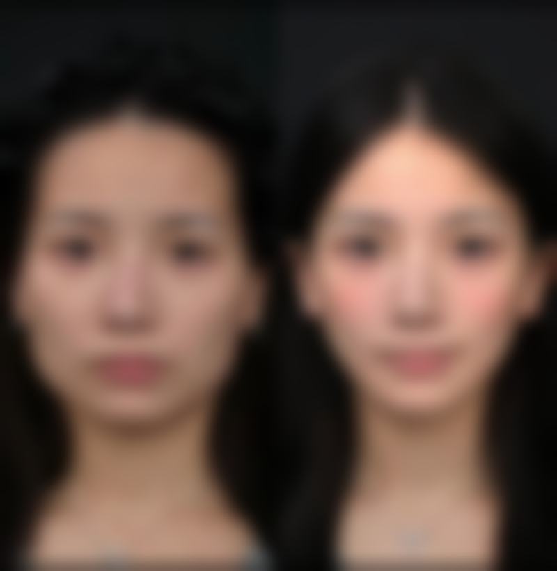 北京怡瑞医疗美容医院综合评价