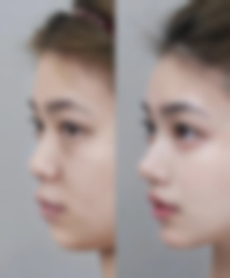 三、医疗机构等级对价格的影响