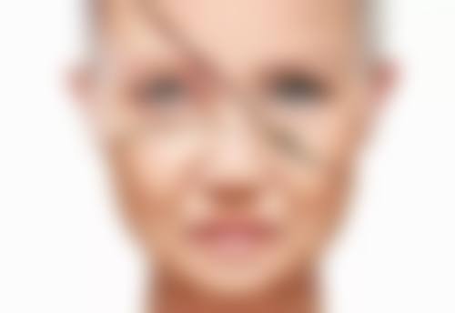 广州韩妃风筝小拉皮手术与其他拉皮手术的对比