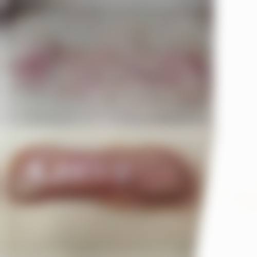 放射疗法修复脸上疤痕