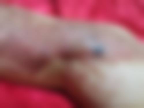 药物修复脸上疤痕