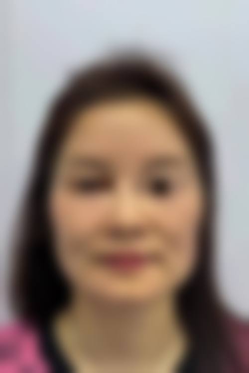 广州韩妃医生团队在风筝小拉皮手术中的作用