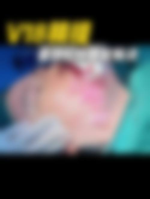 广州韩妃风筝小拉皮手术提升下颌缘的实例分享