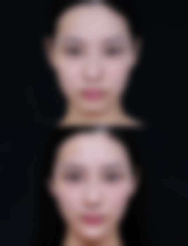 蚌埠靓妹医疗美容门诊部如何预约？