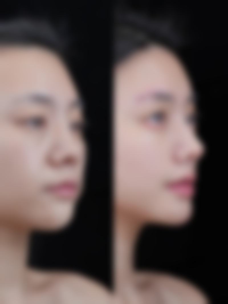 西安美好美容医院收费与用户反馈展示