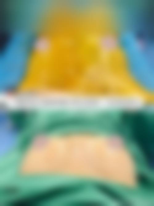 后期用力抓的风险